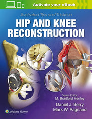 Illustrated Tips and Tricks in Hip Knee Reconstructive Replacement...